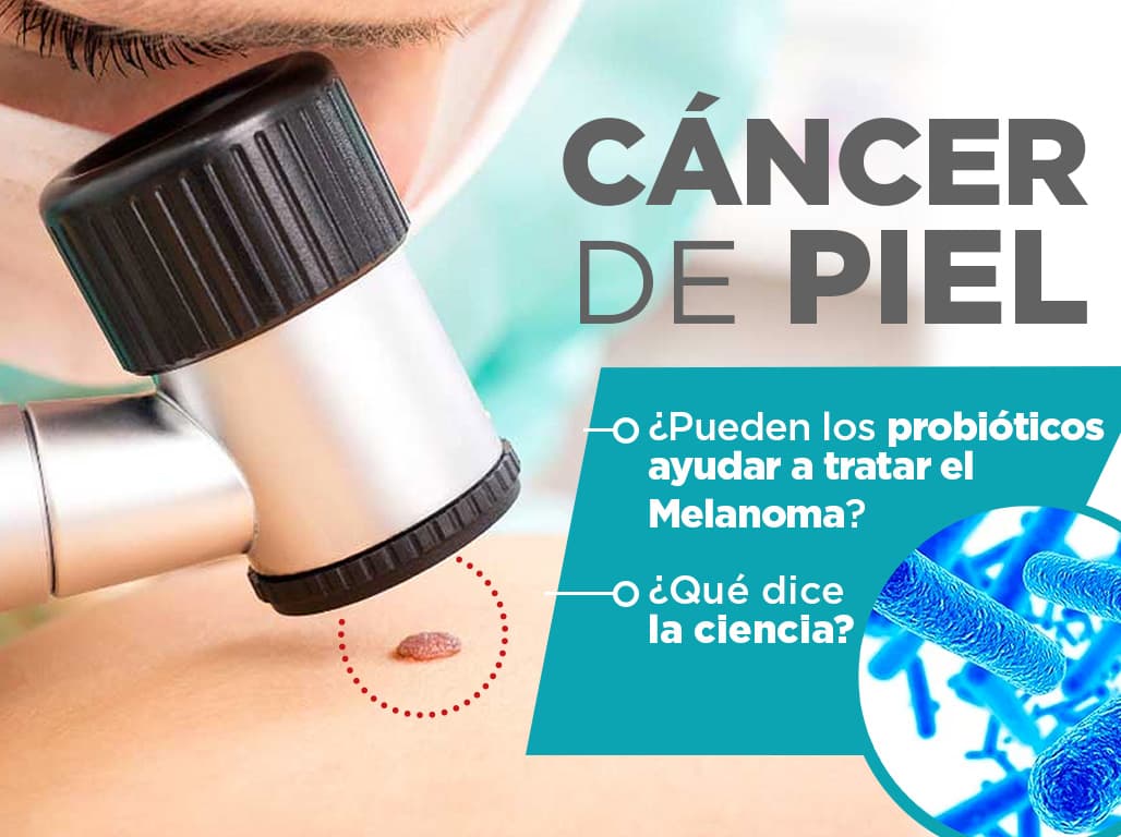 Read more about the article Cáncer de piel. ¿Pueden los probióticos ayudar a tratar el melanoma? ¿Qué dice la ciencia?
